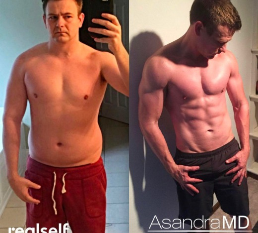 Patient transformation — @nautiskin