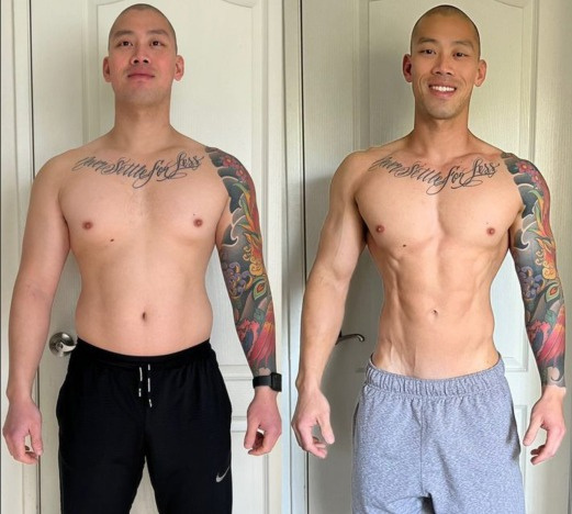 Patient transformation — @jadoo247